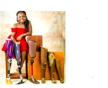 Beulah: Restoring hope to child-amputees, driving inclusive education
