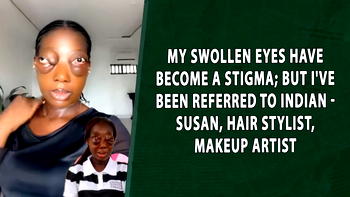 My Swollen Eyes Have Become A Stigma; But I’ve Been Referred To Indian – Susan, Makeup Artist