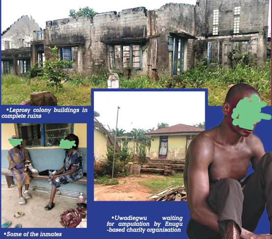 Neglected, isolated: Untold story of Uzuakoli leprosy colony inmates