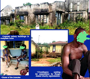 Neglected, isolated: Untold story of Uzuakoli leprosy colony inmates