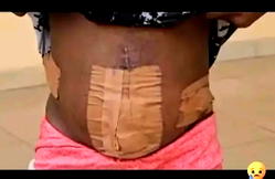 Nigerian teen trafficked to Ivory Coast for prostitution loses womb