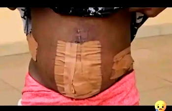 Nigerian teen trafficked to Ivory Coast for prostitution loses womb