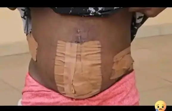 Nigerian teen trafficked to Ivory Coast for prostitution loses womb