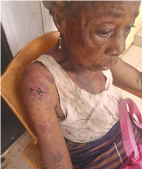 Abia widow, 90, struggles for survival after ongoing attacks by brother's wife and children