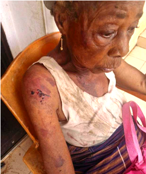 At 90, Abia widow fights for life amid repeated assault by brother’s wife, kids