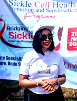 World Sickle Cell Day: Onolememen hails NDDC for bringing hope to affected families