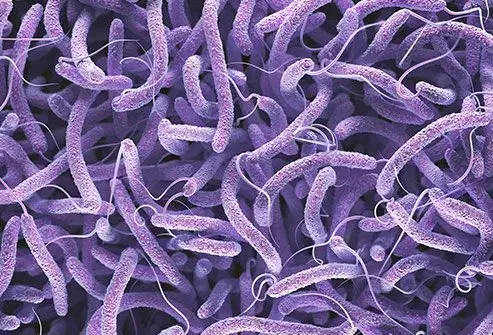 5 dead, 11 confirmed cases in Plateau cholera outbreak