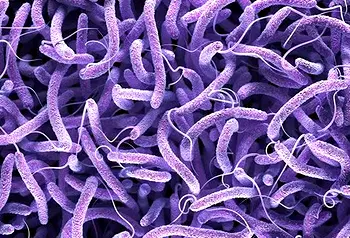 5 dead, 11 confirmed cases in Plateau cholera outbreak