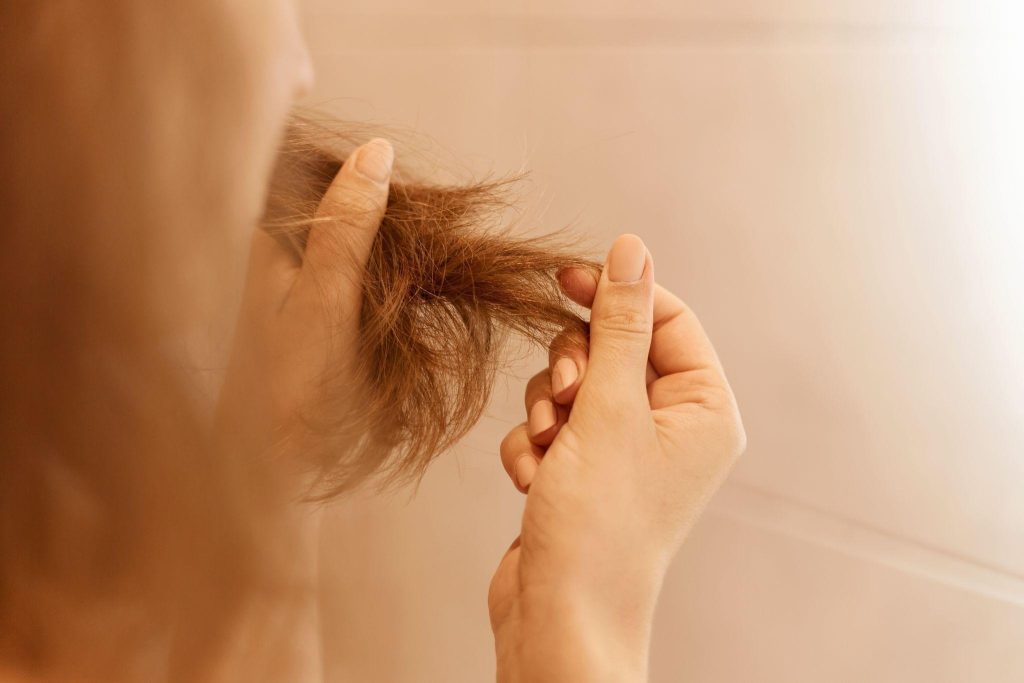 The Hidden Connection Between Persistent Flakes and Long-Term Balding