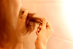 The Hidden Connection Between Persistent Flakes and Long-Term Balding