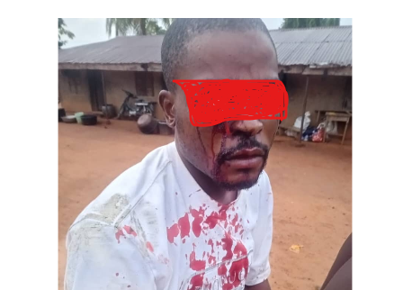 Ebonyi police arrest officers over alleged assault, brutalisation of man, launch investigation
