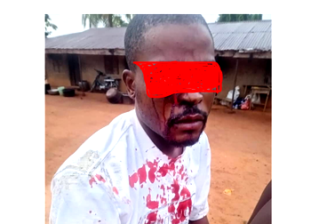Ebonyi police arrest officers over alleged assault, brutalisation of man, launch investigation
