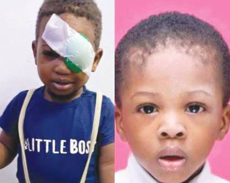 NDLEA shooting: Parents of slain toddler seek compensation as survivor brother, 4, loses eye