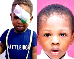 NDLEA shooting: Parents of slain toddler seek compensation as survivor brother, 4, loses eye