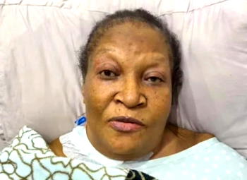 Otti approves payment of first phase of Ngozi Nwosu’s medical bills