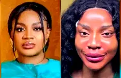 Uche Ogbodo reveals ‘new face’ after non-surgical procedure