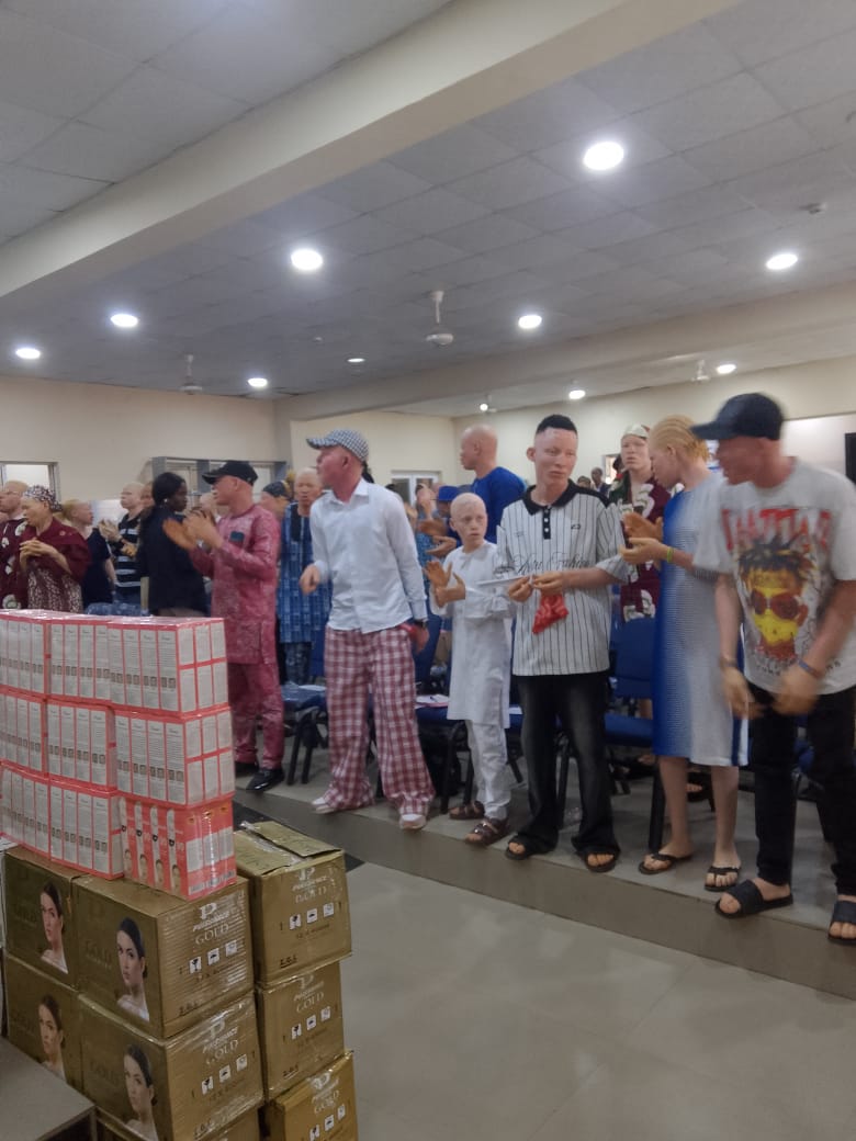 Aiyedatiwa assures persons with albinism of equal opportunities