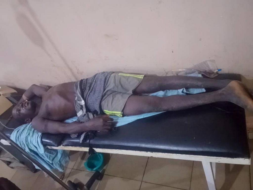 Sokoto attack : Beggar’s son shot by terrorist needs N190,000 for scan