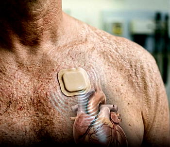 Heartbeat by sound: Scientists develop non-invasive pacemaker
