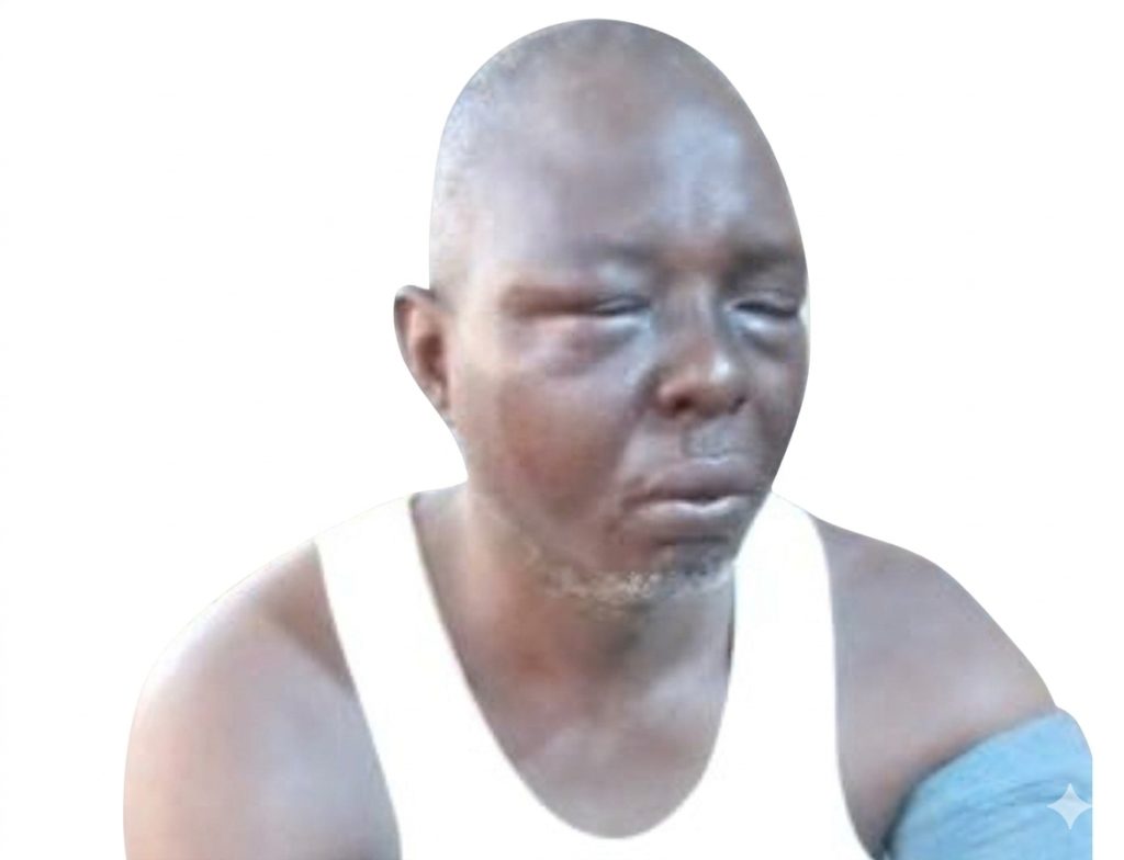 Adeda after the fatal assault
